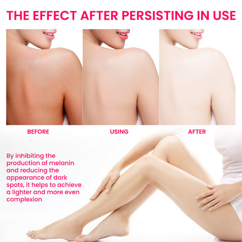 PigmentEase Skin Solution